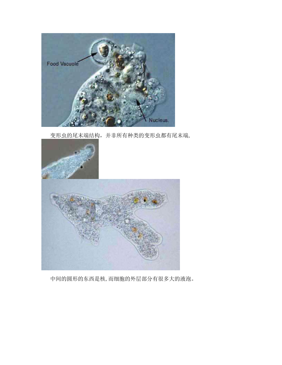 污水处理常见微生物照片