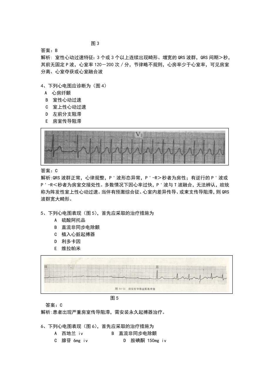 心电图精华50题.doc