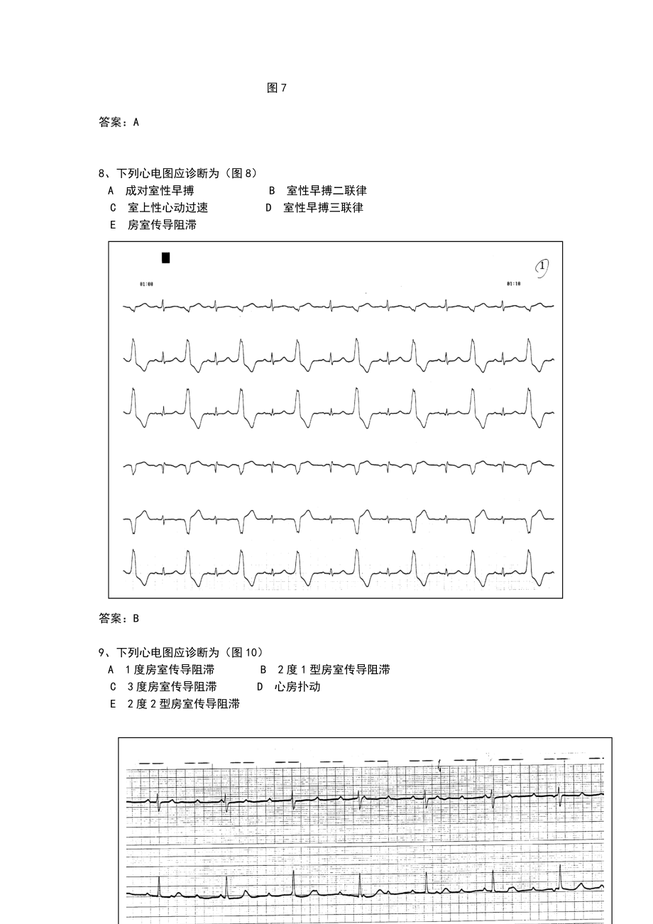 心电图精华50题.doc