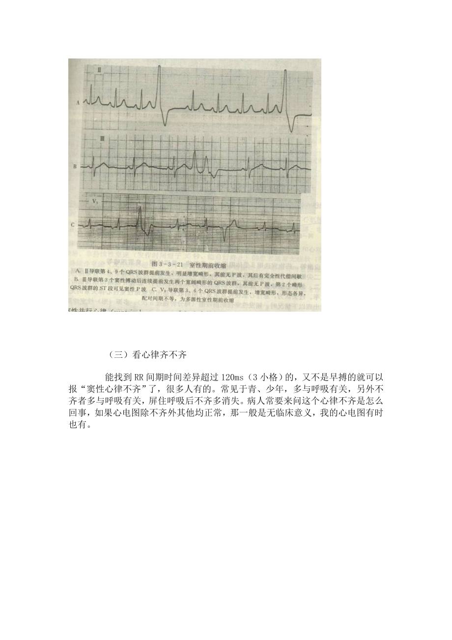 如何看懂心电图.doc