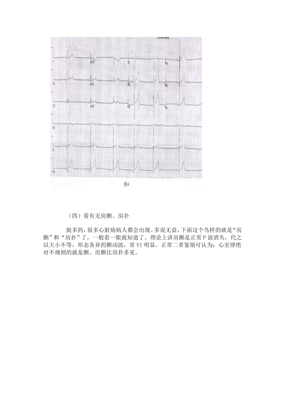 如何看懂心电图.doc